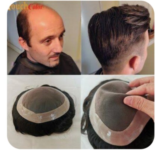 Non surgical human hair treatment available hair patch wigs